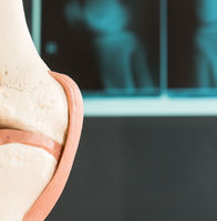 IBRA International Conference - All Around the Scaphoid